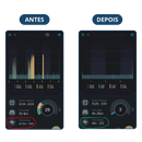 Protetor Bucal Anti-Ronco Zonorex®