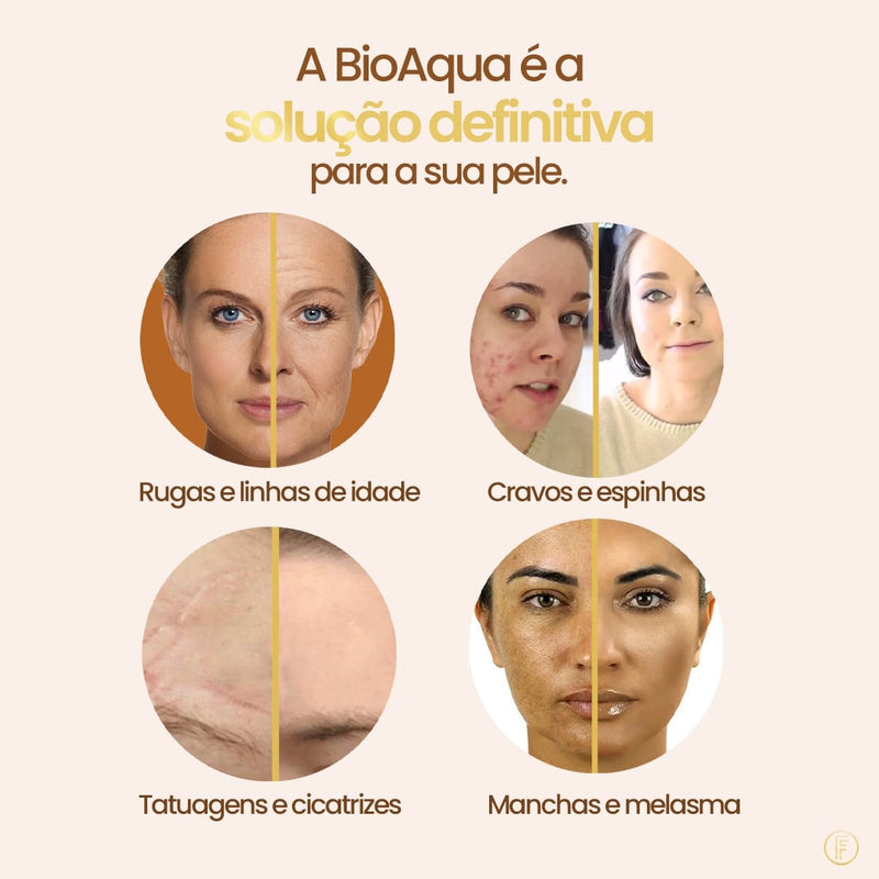 Base Profissional - BioAqua™ [Compre 1 & Leve 2]