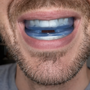 Protetor Bucal Anti-Ronco Znorex®