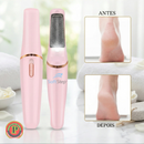 SoftStep™ Lixa Elétrica para Pés Recarregável à Prova d’Água | Pés Macios, Renovados e Bem-Cuidados em Casa